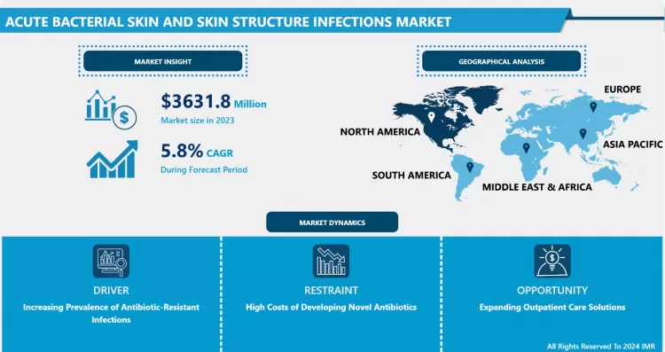 Acute Bacterial Skin and Skin Structure Infections Market - Share Analysis