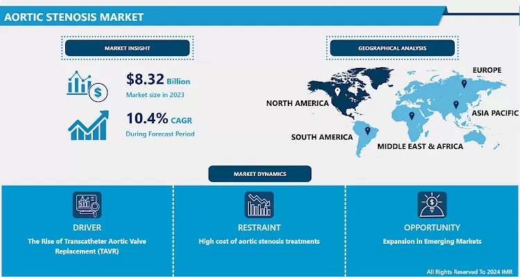 Aortic Stenosis Market - Global Size & Upcoming Industry Trends 2024-2032